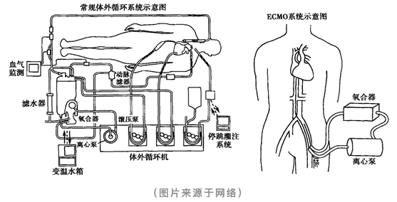 向死神要生命的ECMO：重症监护病房里的终极武器